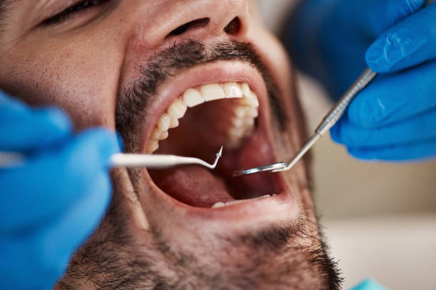Best Urgent Dental Care for Toothache in Ann Arbor, MI