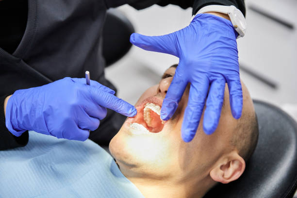 Best Broken or Cracked Tooth Emergency Dentist in Ann Arbor, MI